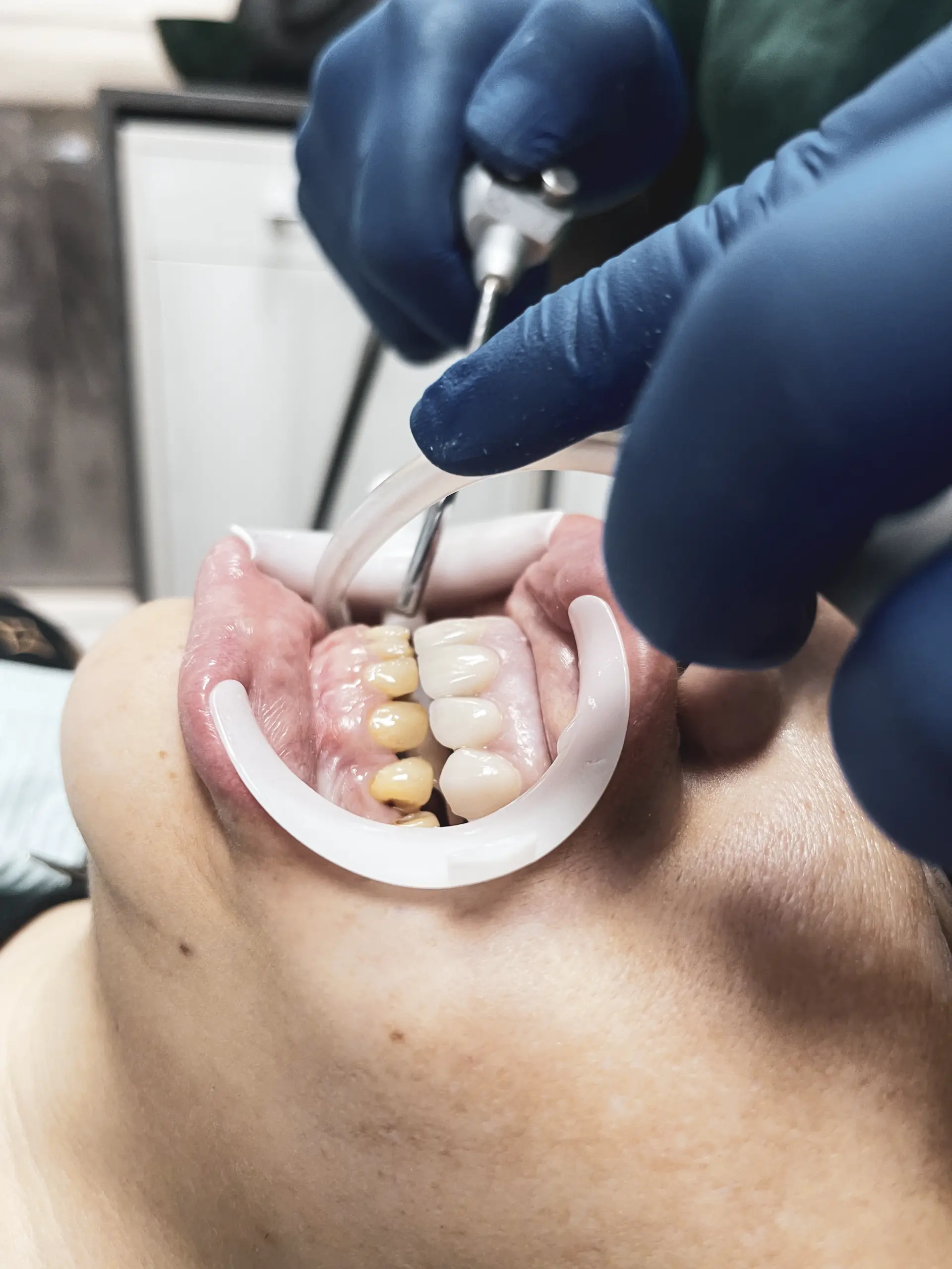Illustrative clinical scene